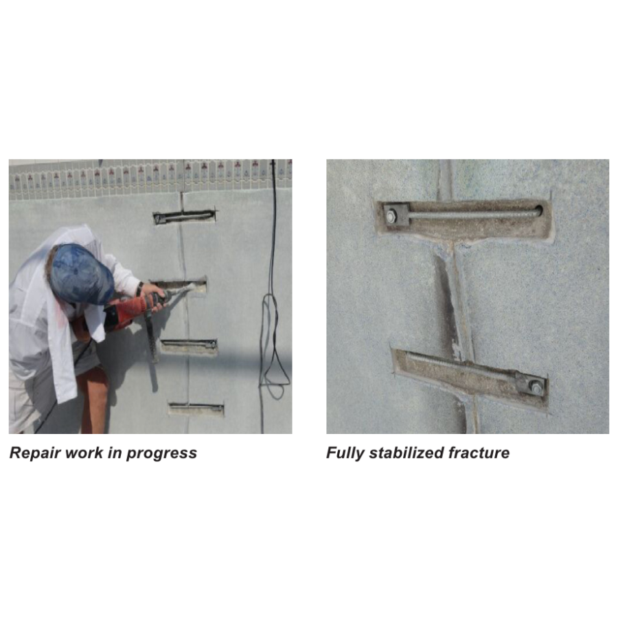 SlabStitch Concrete Crack Repair System (Single Fastener)